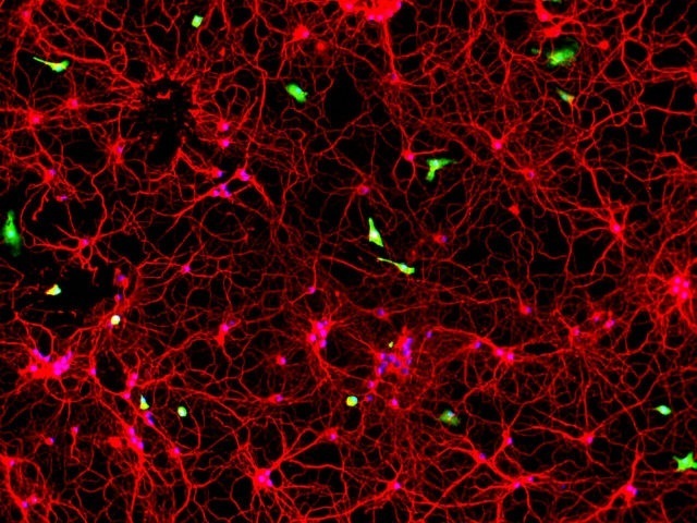 cultivo-celular neuronas microglia