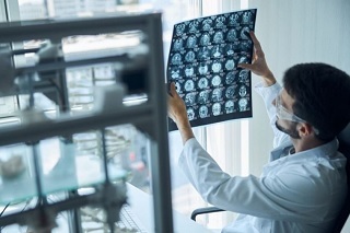 EE.UU. aprueba primer fármaco nuevo para el Alzheimer en casi 20 años