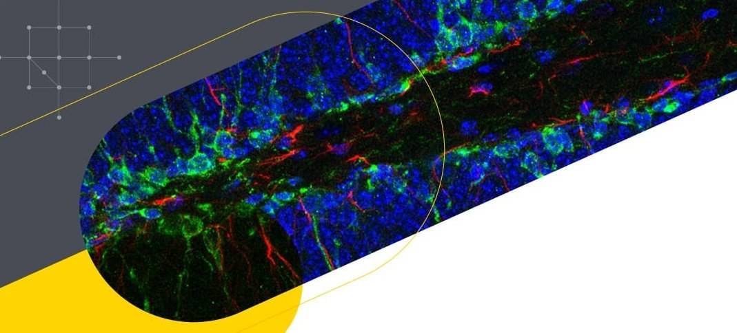Señalización Wnt/RABO en la generación de nuevas neuronas en el cerebro adulto