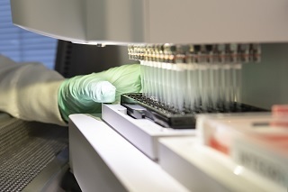 Investigador U. Mayor analizó avances en el estudio sobre Alzheimer y envejecimiento
